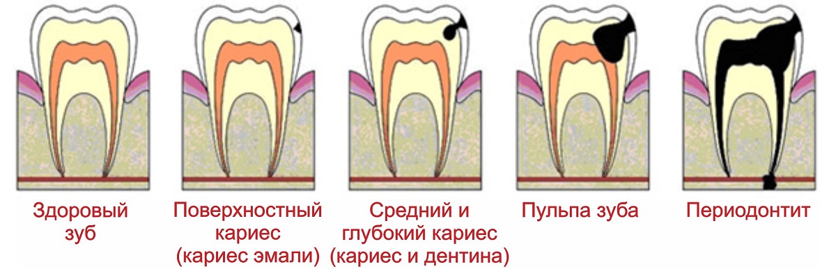 Лечение зубов Николаев